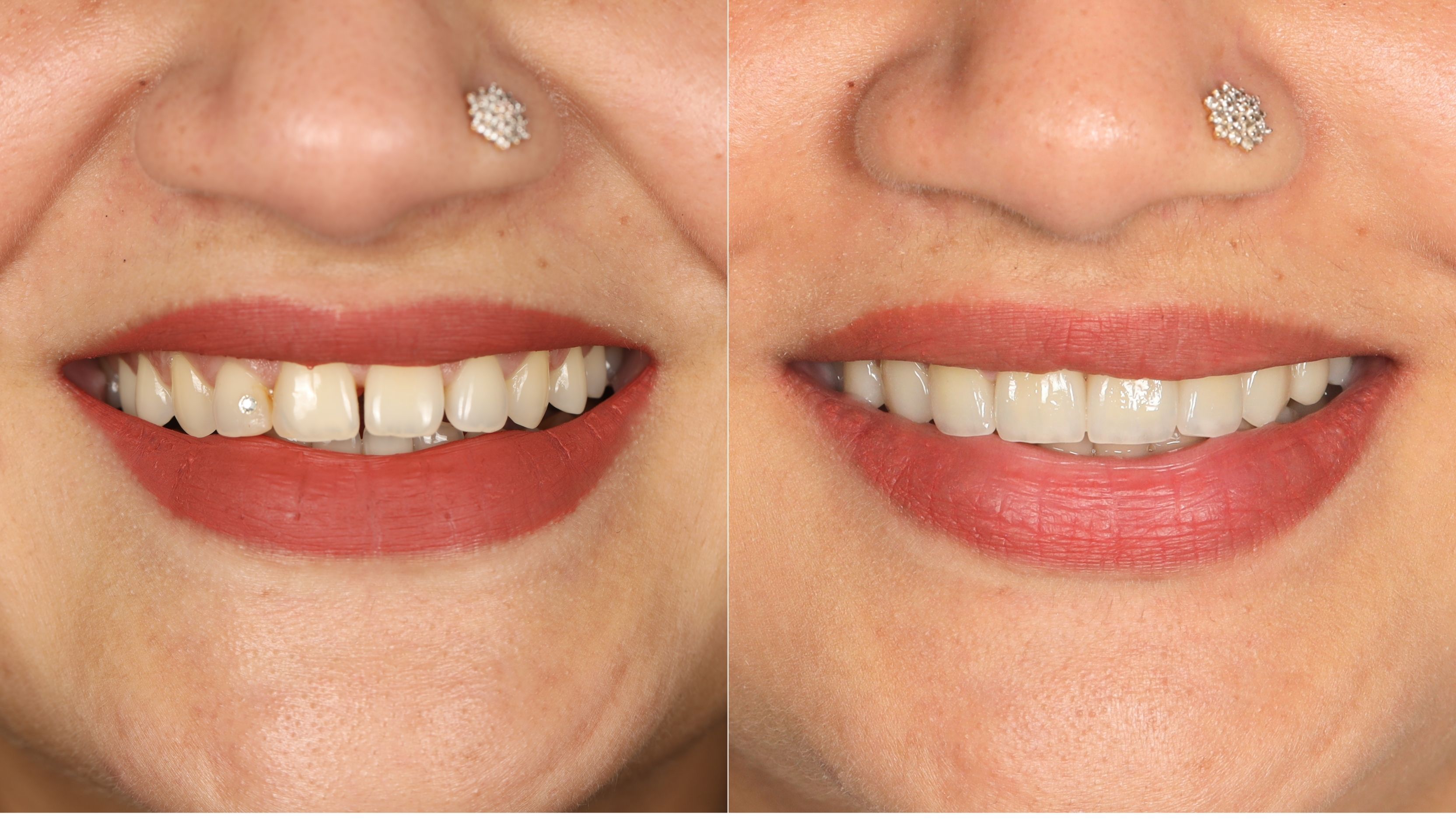 shafna Smilemakeover kottakkal